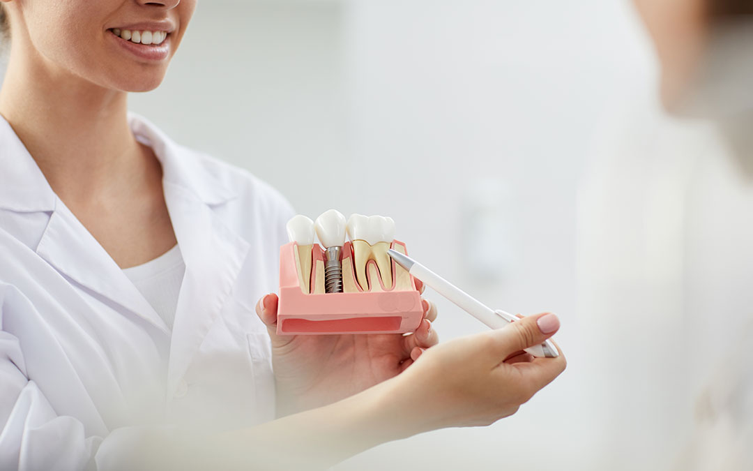 Zubni implant za ugradnju u zigomatičnu kost, Zubni implant za ugradnju u zigomatičnu kost