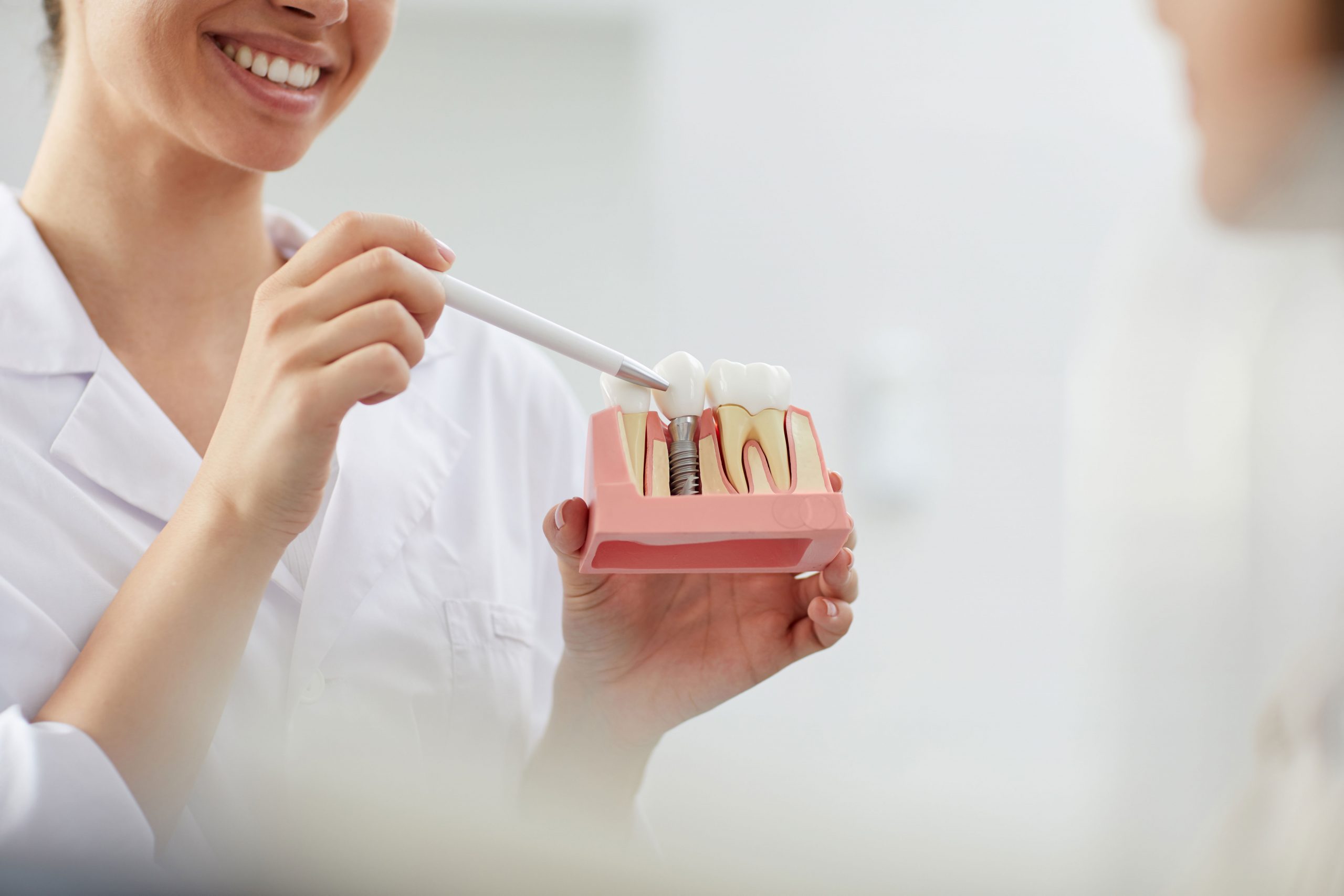 , Povezivanje zubnih implanta i zubnih nadoknada